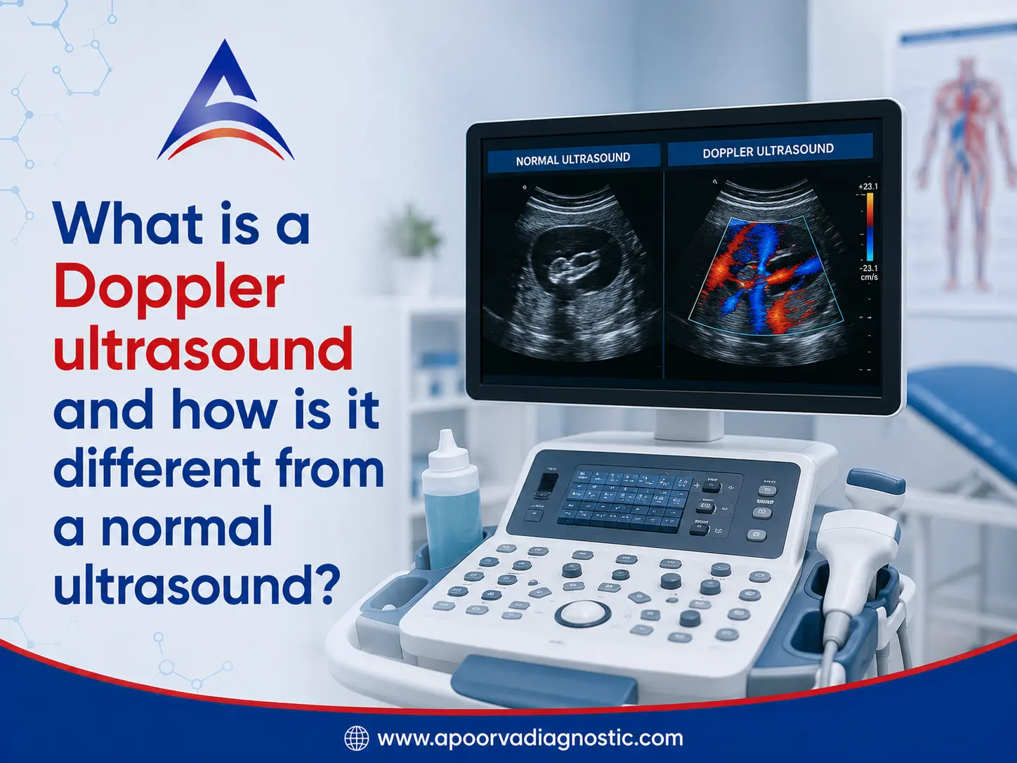 What Is a Doppler Ultrasound